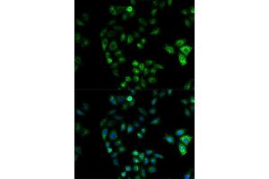 Immunofluorescence analysis of U2OS cell using HSD17B2 antibody.