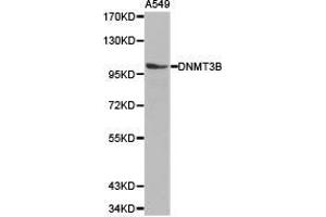 Western Blotting (WB) image for anti-DNA (Cytosine-5-)-Methyltransferase 3 beta (DNMT3B) antibody (ABIN1872328) (DNMT3B anticorps)