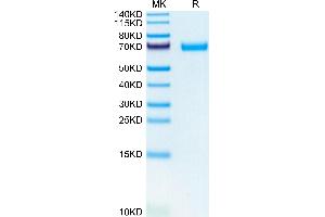 Mouse LIF on Tris-Bis PAGE under reduced condition.