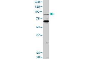 PCAF monoclonal antibody (M04), clone 5E11. (KAT2B anticorps  (AA 353-452))