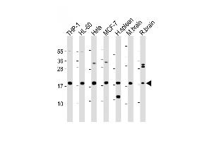 All lanes : Anti-ARPC5 Antibody (Center) at 1:2000 dilution Lane 1: THP-1 whole cell lysate Lane 2: HL-60 whole cell lysate Lane 3: Hela whole cell lysate Lane 4: MCF-7 whole cell lysate Lane 5: Human spleen lysate Lane 6: Mouse brain lysate Lane 7: Rat brain lysate Lysates/proteins at 20 μg per lane.