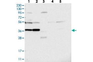 Western blot analysis of Lane 1: RT-4, Lane 2: U-251 MG, Lane 3: Human Plasma, Lane 4: Liver, Lane 5: Tonsil with PRUNE2 polyclonal antibody  at 1:250-1:500 dilution. (PRUNE2 anticorps)
