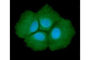 ICC/IF analysis of ADSL in Hep3B cells line, stained with DAPI (Blue) for nucleus staining and monoclonal anti-human ADSL antibody (1:100) with goat anti-mouse IgG-Alexa fluor 488 conjugate (Green). (Adenylosuccinate Lyase anticorps  (AA 1-484))