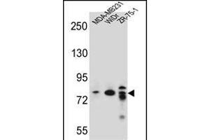 ARHG Antibody (C-term) (ABIN656937 and ABIN2846128) western blot analysis in MDA-M,WiDr,ZR-75-1 cell line lysates (35 μg/lane). (ARHGAP22 anticorps  (C-Term))
