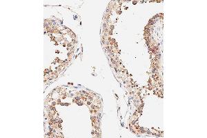 Immunohistochemical analysis of paraffin-embedded human testis tissue using B performed on the Leica® BOND RXm. (DLL3 anticorps  (C-Term))