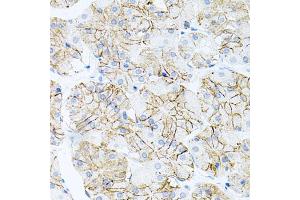 Immunohistochemistry of paraffin-embedded human stomach using IL17A antibody (ABIN6290529) at dilution of 1:100 (40x lens). (Interleukin 17a anticorps)