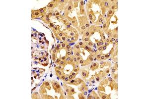 (ABIN6242522 and ABIN6577190) staining PGK1 in human kidney tissue sections by Immunohistochemistry (IHC-P - paraformaldehyde-fixed, paraffin-embedded sections). (PGK1 anticorps  (AA 1-417))