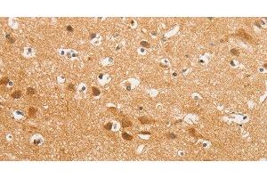 Immunohistochemistry of paraffin-embedded Human brain using K-Cadherin Polyclonal Antibody at dilution of 1:50