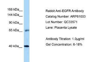 Western Blotting (WB) image for anti-Epidermal Growth Factor Receptor (EGFR) (Middle Region) antibody (ABIN2788648) (EGFR anticorps  (Middle Region))