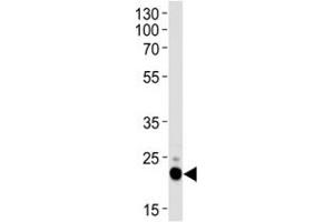 Western blot analysis of lysate from HeLa cell line using CD9 antibody.