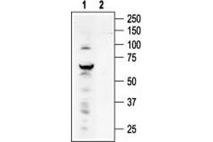 Western blot analysis of ND7/23 Mouse neuroblastoma /rat dorsal root ganglion neuron hybrid cell line lysate: - 1. (TRPV4 anticorps  (C-Term, Intracellular))
