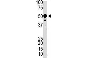 Western blot testing of SUV39H2 antibody and mouse kidney tissue lysate