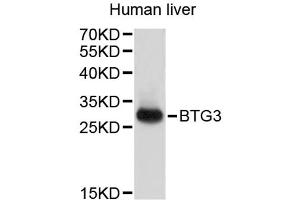 Western blot analysis of extracts of human liver, using BTG3 antibody (ABIN3048296). (BTG3 anticorps)