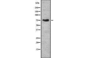 Western blot analysis of THOC1 using COLO205 whole cell lysates (THOC1 anticorps  (C-Term))