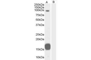 Western Blotting (WB) image for anti-rho GTPase Activating Protein 26 (ARHGAP26) (C-Term) antibody (ABIN2465789) (GRAF anticorps  (C-Term))