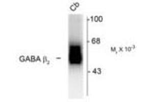 Image no. 1 for anti-gamma-aminobutyric Acid (GABA) A Receptor, beta 2 (GABRB2) (Cytoplasmic Domain) antibody (ABIN228403) (GABRB2 anticorps  (Cytoplasmic Domain))
