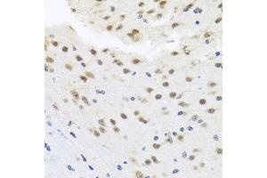 Immunohistochemistry of paraffin-embedded mouse brain using HDAC4 antibody (ABIN4903045) at dilution of 1:100 (40x lens).