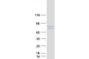 Validation with Western Blot