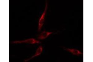 ABIN6275113 staining HepG2 cells by IF/ICC. (Epsin 2 anticorps  (Internal Region))