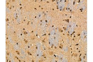 Phospho-IRF7 (Ser471/Ser472) Antibody at 1/100 staining Rat brain tissue by IHC-P.
