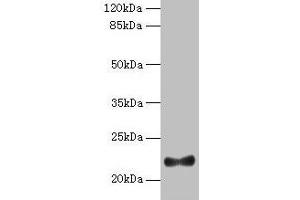 Western blot All lanes: IFNAG antibody at 2 μg/mL + HL60 whole cell lysate Secondary Goat polyclonal to rabbit IgG at 1/10000 dilution Predicted band size: 22 kDa Observed band size: 22 kDa (IFNA5 anticorps  (AA 24-189))