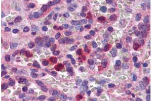 Human Spleen: Formalin-Fixed, Paraffin-Embedded (FFPE)