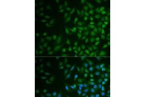 Immunofluorescence analysis of MCF7 cells using MPP2 Polyclonal Antibody