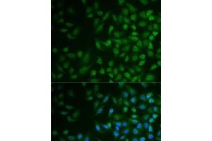 Immunofluorescence analysis of MCF7 cells using MPP2 Polyclonal Antibody (MPP2 anticorps)