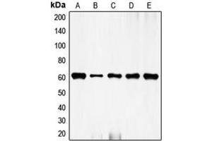Western blot analysis of c-FOS expression in HeLa (A), NIH3T3 (B), mouse brain (C), rat kidney (D), rat brain (E) whole cell lysates. (c-FOS anticorps  (N-Term))