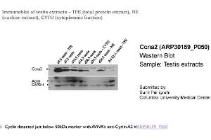 Western Blotting (WB) image for anti-Cyclin A2 (CCNA2) (C-Term) antibody (ABIN2779289) (Cyclin A anticorps  (C-Term))