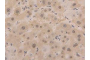 Detection of GAPDH in Human Liver Tissue using Polyclonal Antibody to Glyceraldehyde-3-Phosphate Dehydrogenase (GAPDH) (GAPDH anticorps  (AA 2-148))