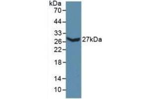 Detection of Recombinant COL3a1, Mouse using Polyclonal Antibody to Collagen Type III Alpha 1 (COL3a1) (COL3A1 anticorps  (AA 434-643))