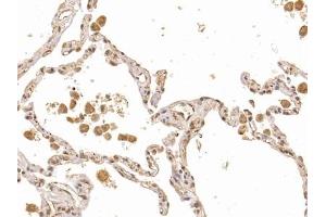 Detection of FLI1 in Human Lung Tissue using Polyclonal Antibody to Friend Leukemia Virus Integration 1 (FLI1)