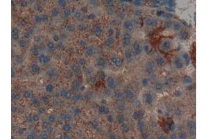 Detection of LIFR in Rat Liver Tissue using Polyclonal Antibody to Leukemia Inhibitory Factor Receptor (LIFR)