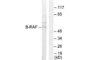 Immunohistochemistry analysis of paraffin-embedded human brain tissue using B-RAF antibody.