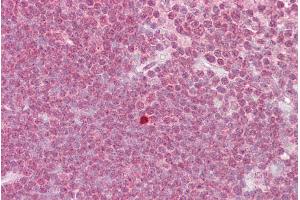 Immunohistochemistry with Thymus tissue at an antibody concentration of 5µg/ml using anti-ZBTB7A antibody (ARP39211_P050)