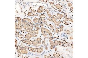 IHC analysis of SNRNP27 using anti-SNRNP27 antibody (ABIN7599614). (SNRNP27 anticorps  (AA 100-155))