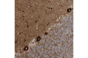 Immunohistochemical staining of human cerebellum with ECM2 polyclonal antibody  shows strong cytoplasmic and nucleolar positivity in purkinje cells at 1:200-1:500 dilution. (ECM2 anticorps)