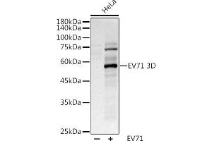 Western blot analysis of extracts of various cell lines, using (ABIN6127666, ABIN6140342, ABIN6140343 and ABIN6224720) at 1:1000 dilution. (EV71 anticorps)