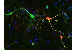 Indirect immunostaining of methanol fixed rat hippocampus neurons with anti-calretinin (dilution 1 : 500; red) and mouse anti-MAP 2 (cat. (Calretinin anticorps)