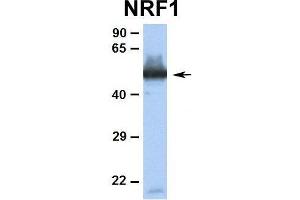 Human Jurkat There is BioGPS gene expression data showing that NRF1 is expressed in Jurkat