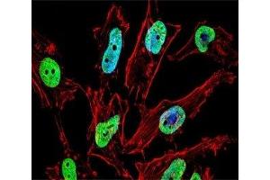 Fluorescent confocal image of HeLa cell stained with NKX1. (NKX1-1 anticorps  (AA 1-1))