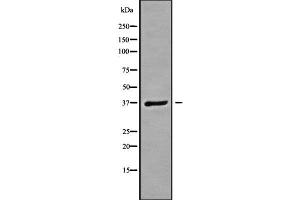 Western blot analysis GNB3 using A549 whole cell lysates (GNB3 anticorps  (C-Term))