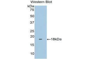 Western blot analysis of the recombinant protein. (FNDC5 anticorps  (AA 2-137))