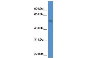 WB Suggested Anti-MKNK1 AntibodyTitration: 1.