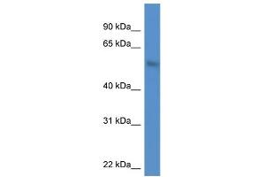 WB Suggested Anti-MKNK1 AntibodyTitration: 1. (MKNK1 anticorps  (N-Term))