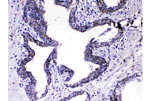 IHC analysis of Relaxin 1 using anti-Relaxin 1 antibody .