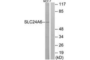 Western blot analysis of extracts from MCF-7 cells, using SLC24A6 Antibody. (SLC24A6 anticorps  (AA 494-543))