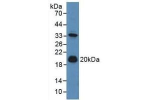 Detection of ADM in Mouse Liver Tissue using Polyclonal Antibody to Adrenomedullin (ADM) (Adrenomedullin anticorps  (AA 24-171))