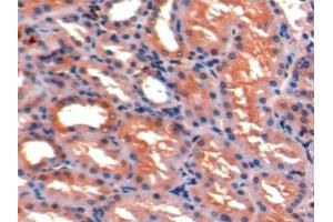 Detection of ICAM1 in Porcine Kidney Tissue using Polyclonal Antibody to Intercellular Adhesion Molecule 1 (ICAM1)